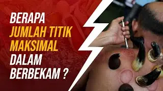 What Is the Maximum Number of Cupping Points?