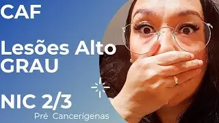 Fiz a CAF -Lesão Alto Grau NIC 2/3 - Pré Cancerígena- Colo do Útero