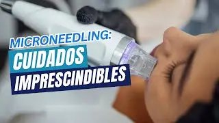 ¿Te hiciste un tratamiento con microneedling? Sigue estas recomendaciones clave/ Odontoespecialistas
