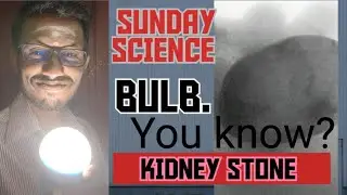 SUNDAY SCIENCE - BULB 💡 KIDNEY STONE 🪨