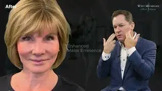 My Facelift Journey - Roxanne's Experience With Plastic Surgeon Dr. Scott Holley