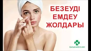Безеуді емдеу жолары
