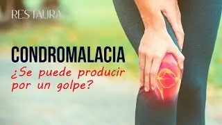 La condromalacia ¿Se puede producir por un golpe?