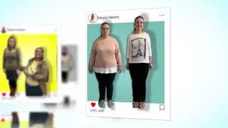 OBEZİTE CERRAHİSİ İLE DEĞİŞEN HAYATLAR