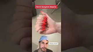 Too many fingers! 