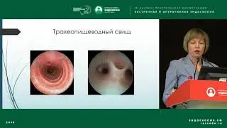 Эндоскопия в детской хирургии