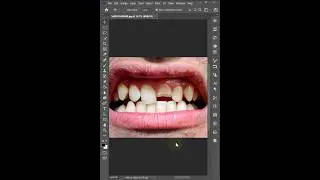 Tooth Correction in Photoshop - Photoshop For Beginners