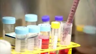 Brazilian viper venom may become a tool in fight against COVID-19