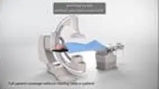 Alphenix C-arm flexibility customer testimonial – Waikato Hospital user experience
