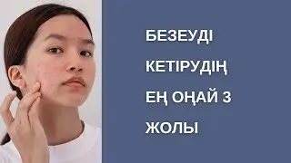 1 күнде безеу кетіру жолы | Безеуді қалай кетіруге болады?