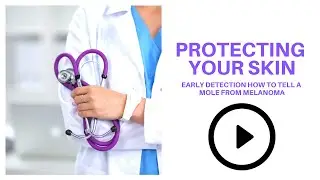 Protecting your skin early detection how to tell a mole from melanoma