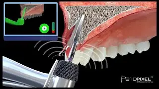 Vídeos 3D dentales - Los mejores trabajos Periopixel 2022
