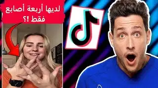 أكثر الحالات الطبية إثارة للصدمة على تيك توك .. الحالة الأخيرة ستصدمك حقا ..!