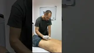 Блокада триггерных точек 