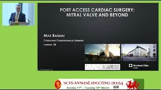 SCTS 2024 | "Port-Access Cardiac Surgery: Mitral Valve and Beyond" With Max Baghai