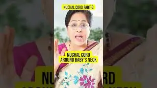 Nuchal Cord in pregnancy explained 