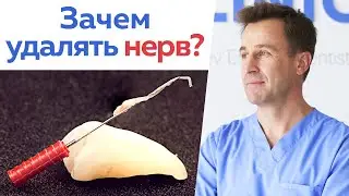 Everything you need to know about tooth nerve removal! / Should you have your tooth nerve removed?