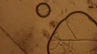 micro world