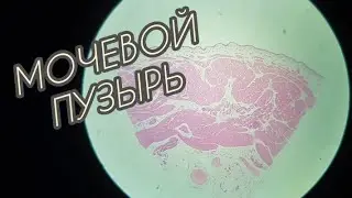 МОЧЕВОЙ ПУЗЫРЬ