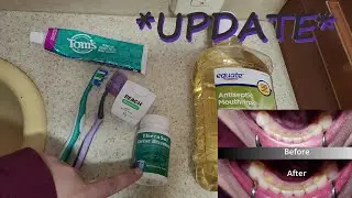 Updated How to Get Rid of Tartar & Plaque | Aerica Lee