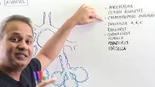Clinical Manifestations of SARS - Coronavirus (SARS-COV)