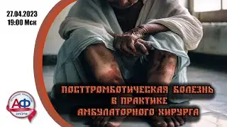 Посттромботическая болезнь в практике амбулаторного хирурга