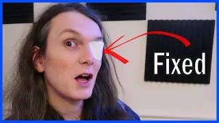 Fixing My Vision With The Power of Science & Odin
