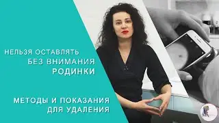 Нельзя оставлять без внимания родинки. Методы и показания для удаления.