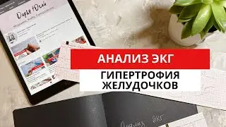 ЭКГ при гипертрофии желудочков. ГЛЖ. ГПЖ. (Гипертрофия левого и  правого желудочков).