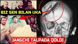 Козоклар учун ёмон хабар!Бош суягини синдиришди,Хабиб Нурмагомедов Куат Хамитов
