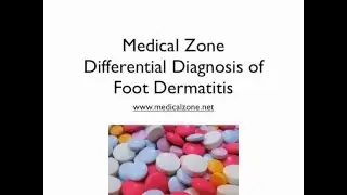 Medical Zone - Differential Diagnosis of Foot Dermatitis