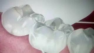 How to floss properly?