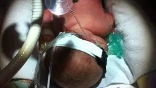 2010 11 23 170606 MOV 703