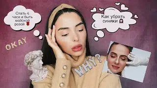 КАК ИЗБАВИТЬСЯ ОТ СИНЯКОВ ПОД ГЛАЗАМИ?