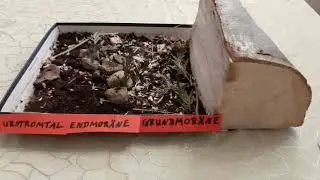 Glaziale Serie