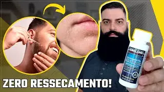Segredos para Manter Sua Barba Hidratada: Como Usar Minoxidil Sem Ressecamento!