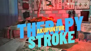 THerapy Akupuntur stroke || meningkatkan sirkulasi Darah ‼️