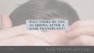 Will there be any scabbing after a hair transplant?