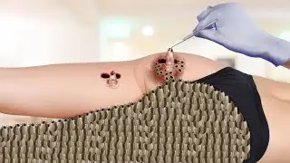 ASMR Treatment 2D Animation | Infected Butt | @HealAsmr914K