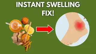 Natural Remedies for Swollen Legs and Feet That Work INSTANTLY!