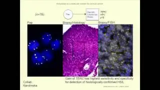 Genome and Transcriptome Dynamics in Cancer Cells - Thomas Ried
