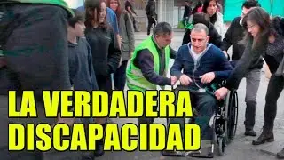 Disability | Social Experiment - The Life of the Sleepless