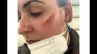 ¿Cómo hacer un arañazo?