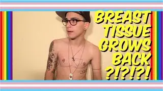 TOP SURGERY W/O TESTOSTERONE!