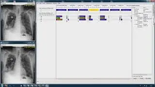 Chimaera SDK Visual Profiling