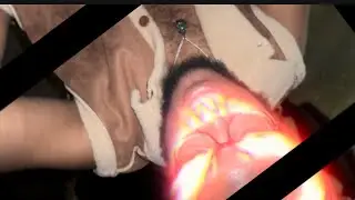 PHARMACY ADDICT - Music Video