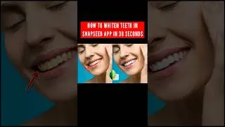 Teeth whitening photo editing | how to whiten teeth in photo | snapseed photo editing #photoediting