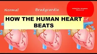 how does the heart beat? #bradycardia #tachycardia #cardiology