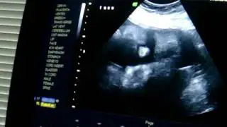 12910.MOV