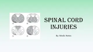 Spinal cord injuries - anterior/posterior/central cord syndrome, Brown Sequard syndrome